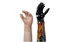 Motoric - Model INDY - Forearm Prosthesis
