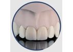 INDURATE - Model ML CT - Multilayer Zirconia Translucent for Dental Restoration