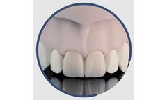 INDURATE - Model ML CT - Multilayer Zirconia Translucent for Dental Restoration