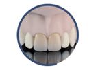 Indurate - Model ML HT - Multilayer Zirconia High-Translucent for Dental Restoration