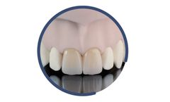 Indurate - Model ML HT - Multilayer Zirconia High-Translucent for Dental Restoration