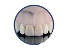 INDURATE - Model ML ET - Multilayer Zirconia Extra-Translucent for Dental Restoration