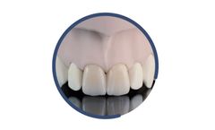 INDURATE - Model ML ET - Multilayer Zirconia Extra-Translucent for Dental Restoration