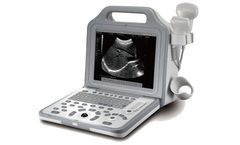 Model Opus-5000 - Ultrasonic Portable Digital Scanner
