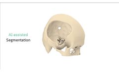 How do surgeon work with Meticuly - Video