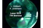 Laser DCR Uni Erlangen - Video