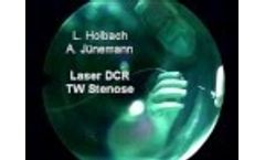 Laser DCR Uni Erlangen - Video