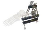 Medin - Model C-Nail - Calcaneal Nail