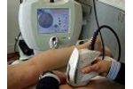 Vascular Laser Treatment with Exotherme - Video
