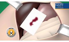 Gelita-Spon Rapid - Video