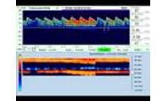 Atysmedical Transcranial doppler - Video