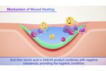Wound Healing Technology of Daeun Medical Korea - Video