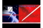 Core Biopsy - Video