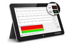 VectraplexECG - Cardiac Electrical Biomarker Software