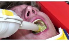 Tytek Medical`s TVAC Manual Suction Unit - Video