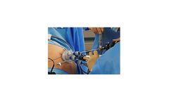 Sejong - Single Port Laparoscopic Surgery