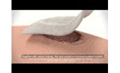 Pluto Ag SFM`s Novel Reinforced Antibacterial Alginate Dressing - Video