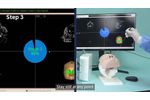 Naviol | ENT Surgical Navigation System - Video
