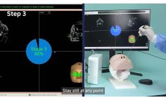Naviol | ENT Surgical Navigation System - Video