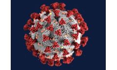 IEH - SARS-CoV-2 RT-PCR Kit