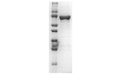 NZYTech - Recombinant Acetyl-CoA Synthetase