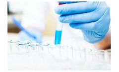 Protein Analysis Services