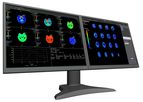 TeraRecon - Version Intuition 4.6 - Turning Medical Imaging into Great Medicine