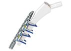 LOQTEQ - Periprosthetic Plating