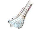 LOQTEQ - Model 2.7/3.5 - Elbow Plates