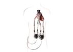 EXCOR - Model Adult - Mechanical, Pulsatile Heart Support System