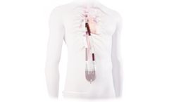 EXCOR - Model Venous Cannula - Subpulmonary Support for your Patients with Failing Fontan Circulation