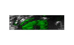 Viscover PolySon - Model H/L - Ultrasound Agents