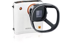 Remex - Model KA6 - Handheld X-Ray Camera