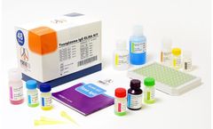 Pishtaz - Model PT-Toxo-Igg-96 - Toxoplasma IgG Elisa Kit