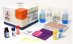 Pishtaz - Model PT-Toxoplasma-Igm-96 - Toxoplasma IgM Elisa Kit