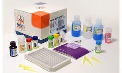 Pishtaz - Model PT-Rub.G-96 - Rubella IgG Elisa Kit