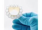 Neovasc Reducer - Treatment of Refractory Angina and Tiara System