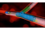 Dedicated Bifurcating Stent by Advanced Bifurcation Systems - Video