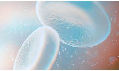 VenoValve - Surgically Implanted Valve for Chronic Venous Disease (CVD)
