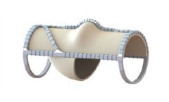 VenoValve - Surgically Implanted Valve