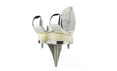 Consensus - Knee System
