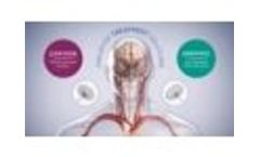 APM017-01.A Cerus Aneurysm Treatment Solutions - Video