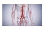 Contour Neurovascular System - Video