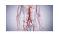 Contour Neurovascular System - Video