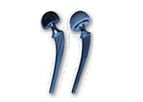 Konknow - Artificial Hip System