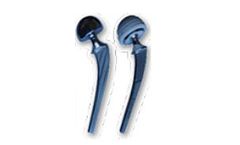 Konknow - Artificial Hip System