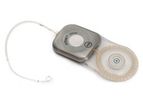HiRes - High Resolution – Low Profile Ultra Cochlear Implant