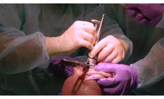 Revision Total Knee Arthroplasty with Exactech Truliant Knee System (Cadaveric) - Video