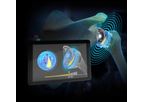 Exactech - Wireless Humeral Load Sensor