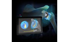 Exactech - Wireless Humeral Load Sensor